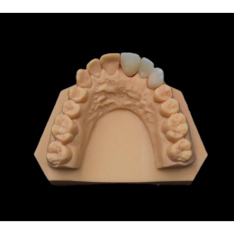 Translucent Finish Dental Zircon Restoration Dental Digital Lab With 7.5 Mohs Hardness