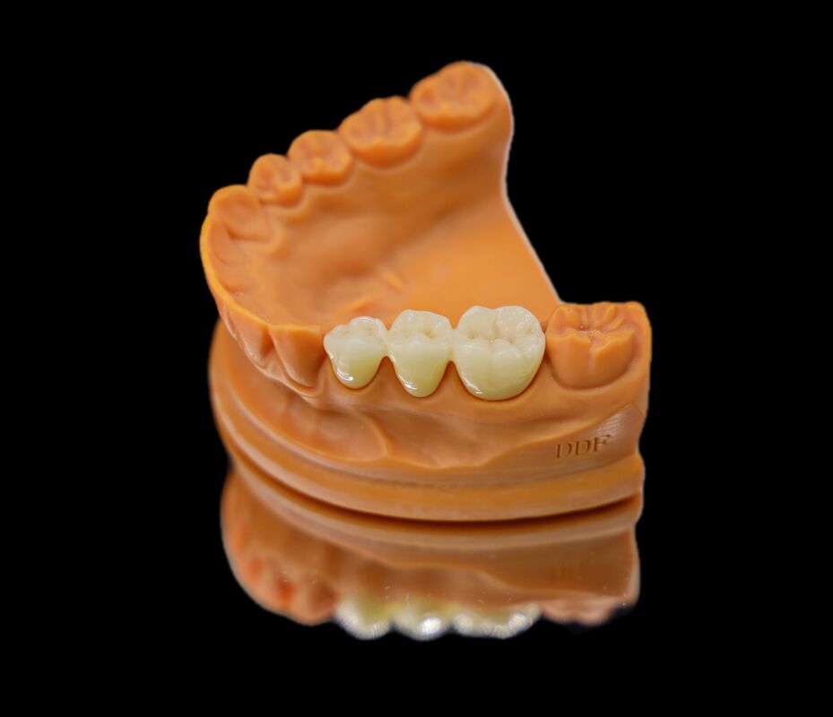 Chinese Dental Laboratory Metal Free Dental Full Zirconia Crown CAD CAM Milling