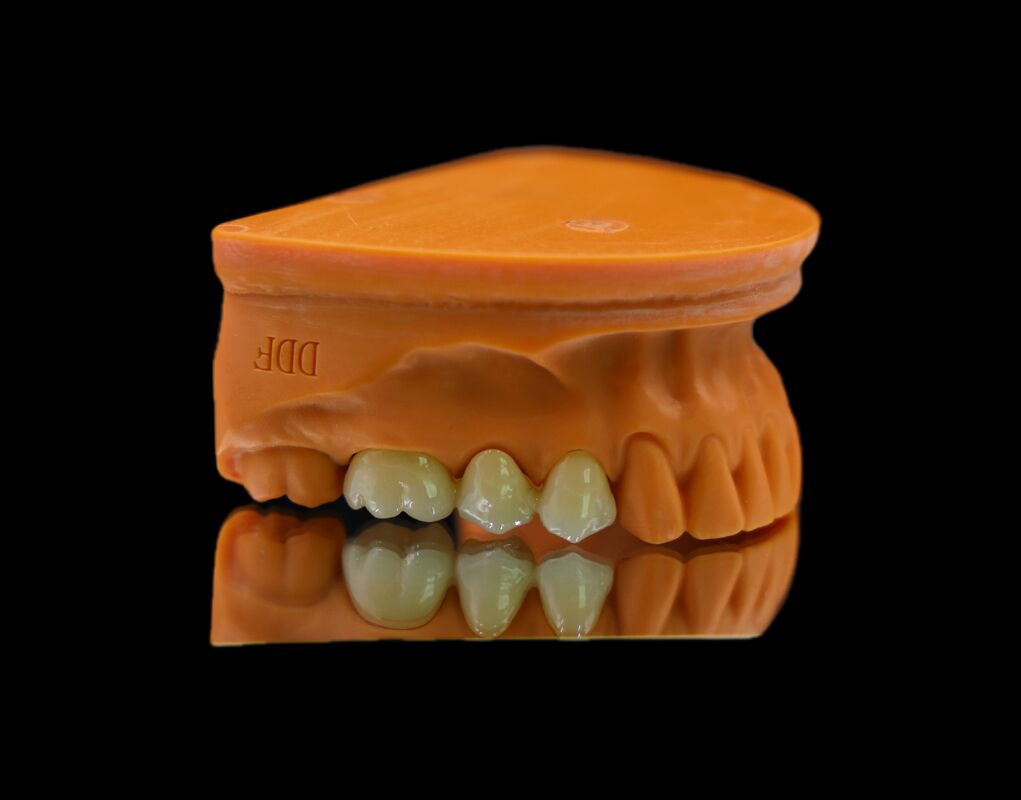 Chinese Dental Laboratory Metal Free Dental Full Zirconia Crown CAD CAM Milling