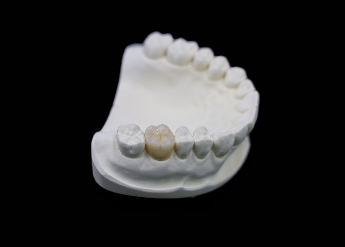 Glossy Surface Dental Zircon Digital Dental Laboratory For Dental Restorations