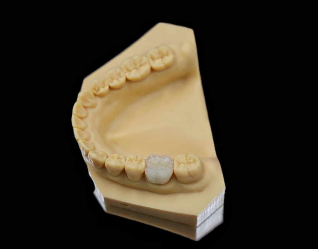 Glossy Surface Dental Zircon Digital Dental Laboratory For Dental Restorations