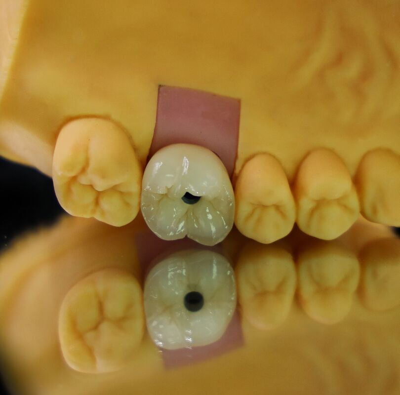 Digital Dental Laboratory Dental Implant System 5.0mm-7.0mm Wide Diameter