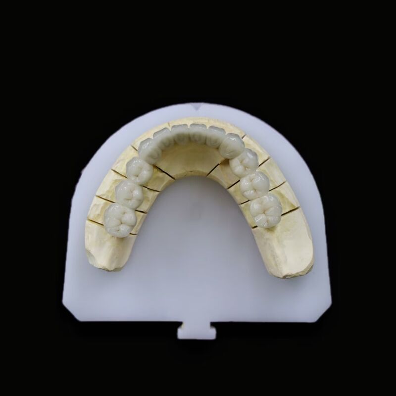 Innovative Dental Zirconia Material Offering High Translucency and Exceptional Mechanical Performance in Dentistry