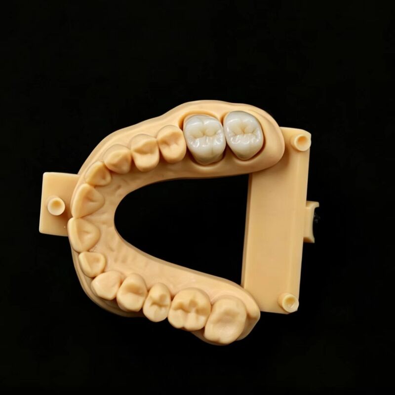 Innovative Dental Zirconia Material Offering High Translucency and Exceptional Mechanical Performance in Dentistry