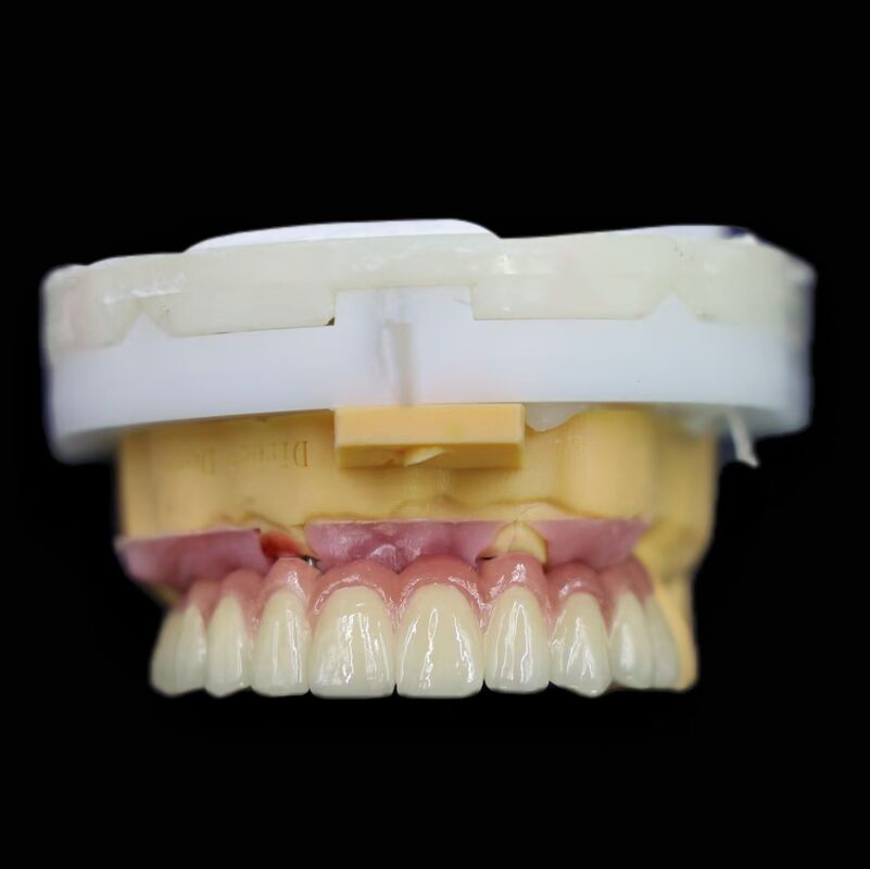 Sterilized Dental Implant System Featuring Biocompatible Materials for Enhanced Osseointegration and Patient Comfort