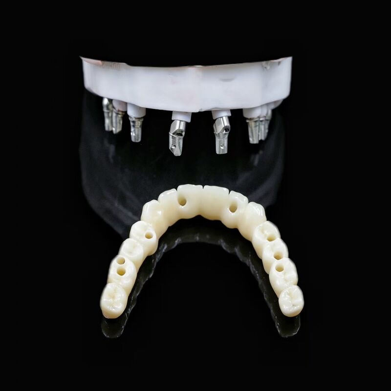 Durable Biocompatible Artificial Tooth Root Implant Suitable for Dental Restoration Procedures and Long Term Stability