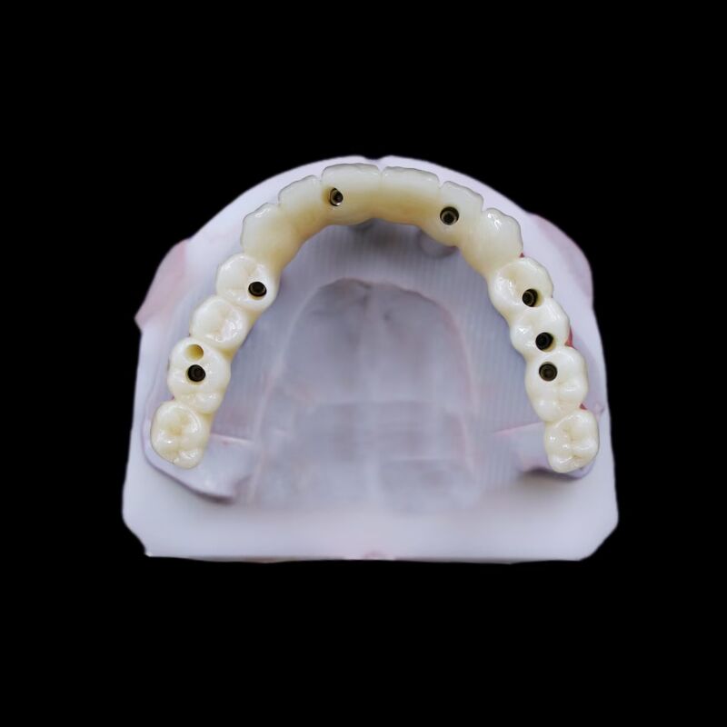 Durable Biocompatible Artificial Tooth Root Implant Suitable for Dental Restoration Procedures and Long Term Stability