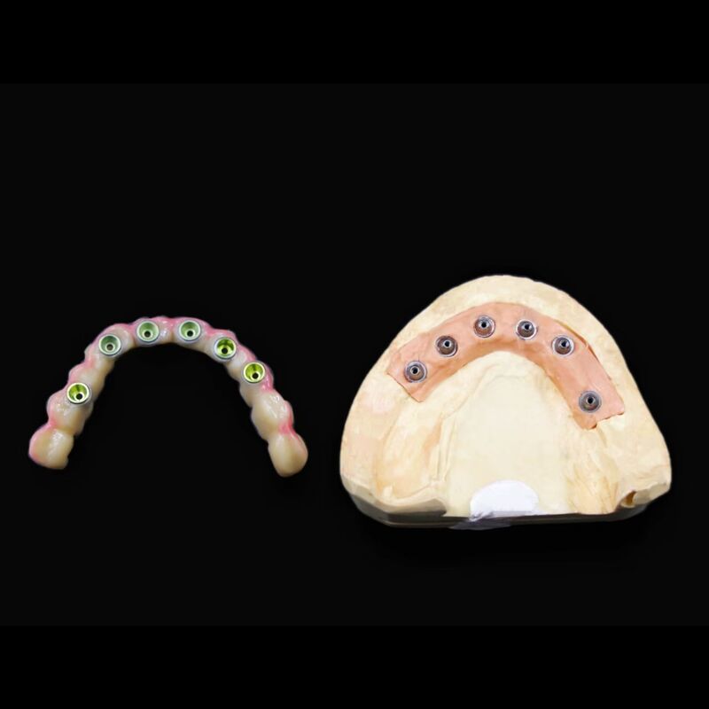 Precision Engineered Artificial Tooth Root Offering Support and Enhanced Healing for Dental Reconstruction Applications
