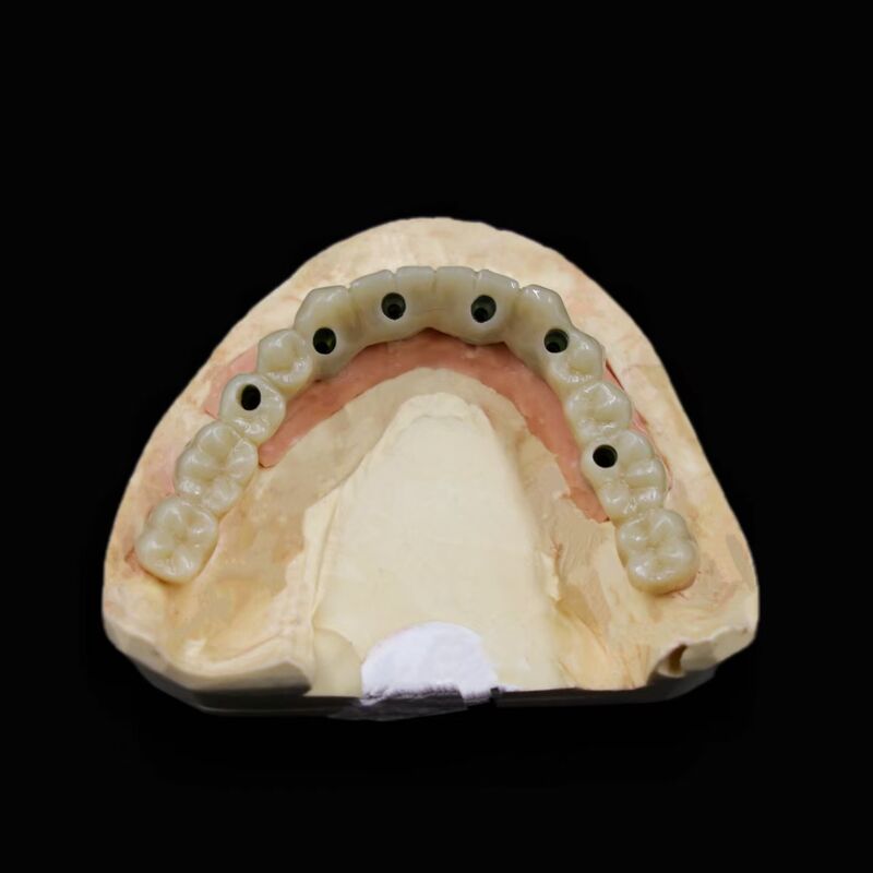 Precision Engineered Artificial Tooth Root Offering Support and Enhanced Healing for Dental Reconstruction Applications
