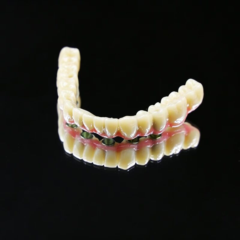 Precision Engineered Artificial Tooth Implant Offering Optimal Fit and Functionality for Effective Dental Rehabilitation