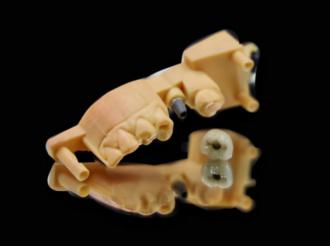 Corrosion Resistant Artificial Tooth Root Suitable for Multiple Dental Applications Providing Secure Implant Fixation
